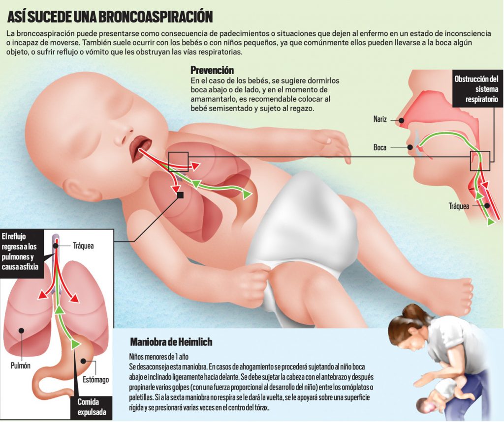 broncoaspiracion