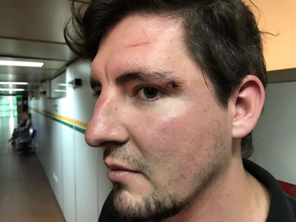 Gaspar Del Vitto, consiliario estudiantil agredido por militantes de la oposición