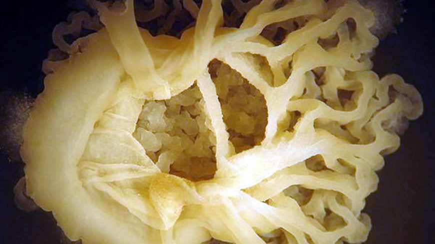La bacteria encontrada