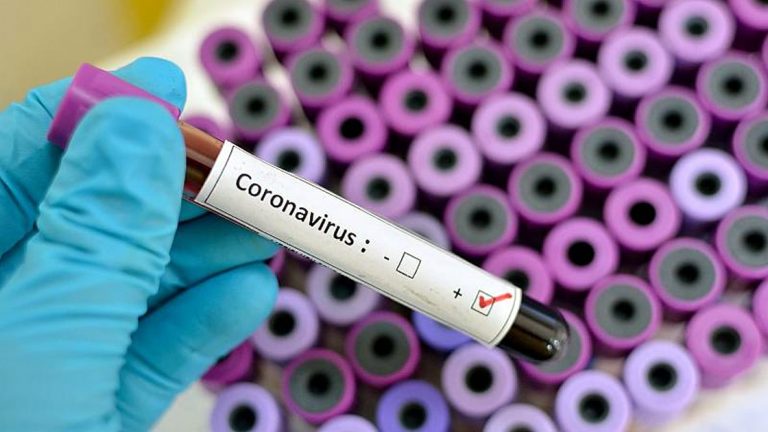 Coronavirus: 919 personas ya se recuperaron en el país