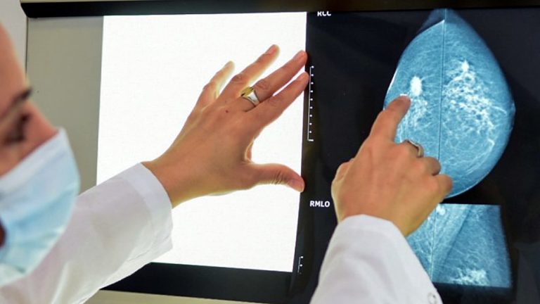 Brindan recomendaciones en el Día Mundial de la Lucha contra el Cáncer de Mama