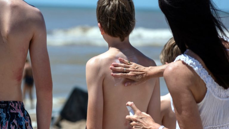 Recomendaciones para evitar efectos dañinos del sol en la piel